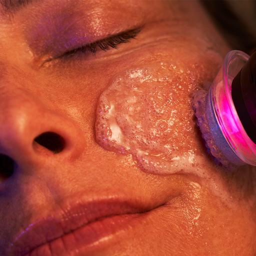 Close-up of a rejuvenating Glo2Facial treatment session.