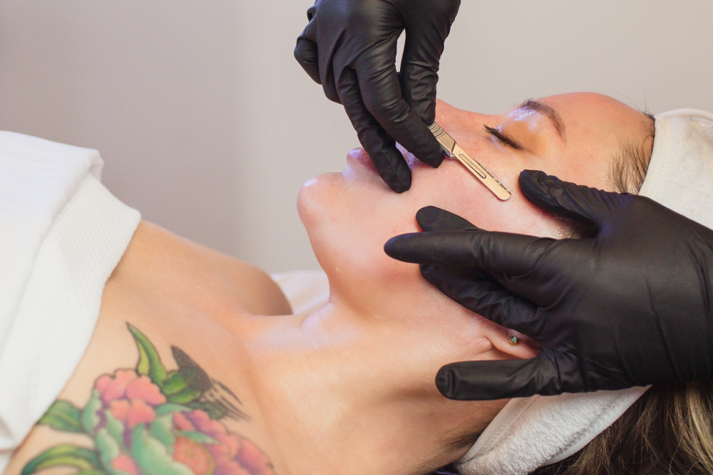 A professional performing dermaplaning on a woman’s cheek using a sterile blade.