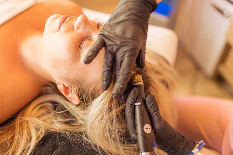 Close-up of Keravive scalp treatment using advanced HydraFacial device.