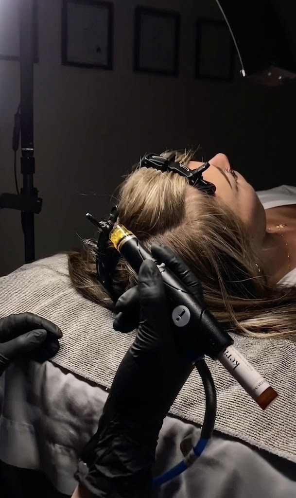 Close-up of a handheld device applied to a person’s scalp with practitioner wearing gloves