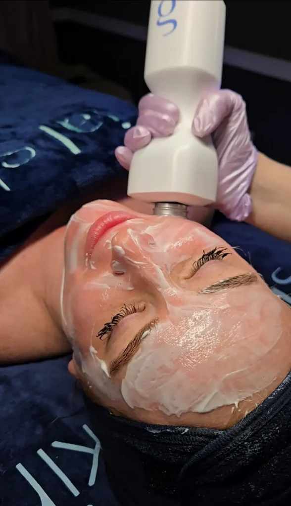 Practitioner using a handheld skincare device on a person's face covered with cream.