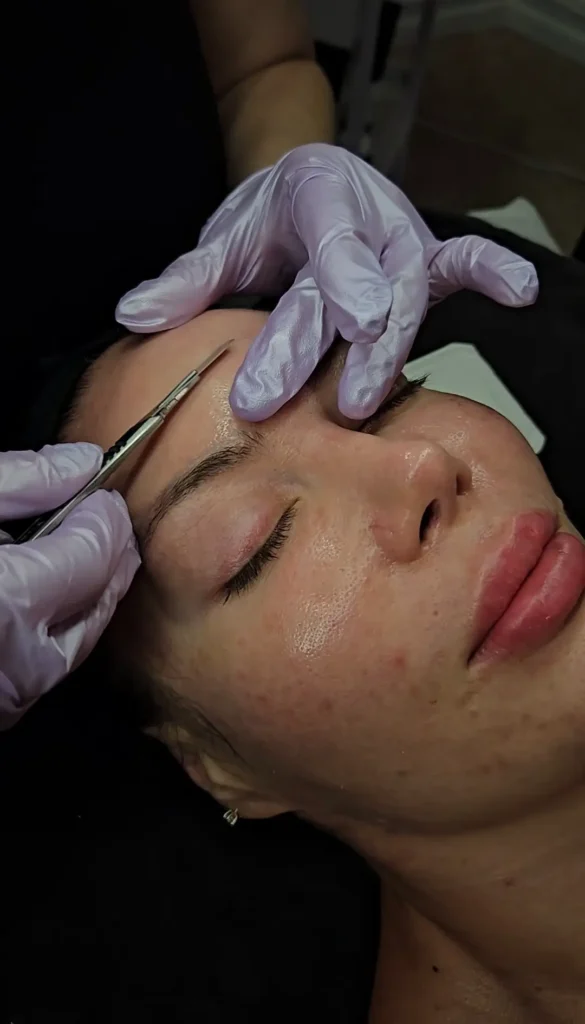 Gloved hands holding skin near the eyebrow while using a dermaplaning tool on the forehead.